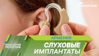 Настроить Звук: Как Проводят Сложные Операции По Восстановлению Слуха В Армении?