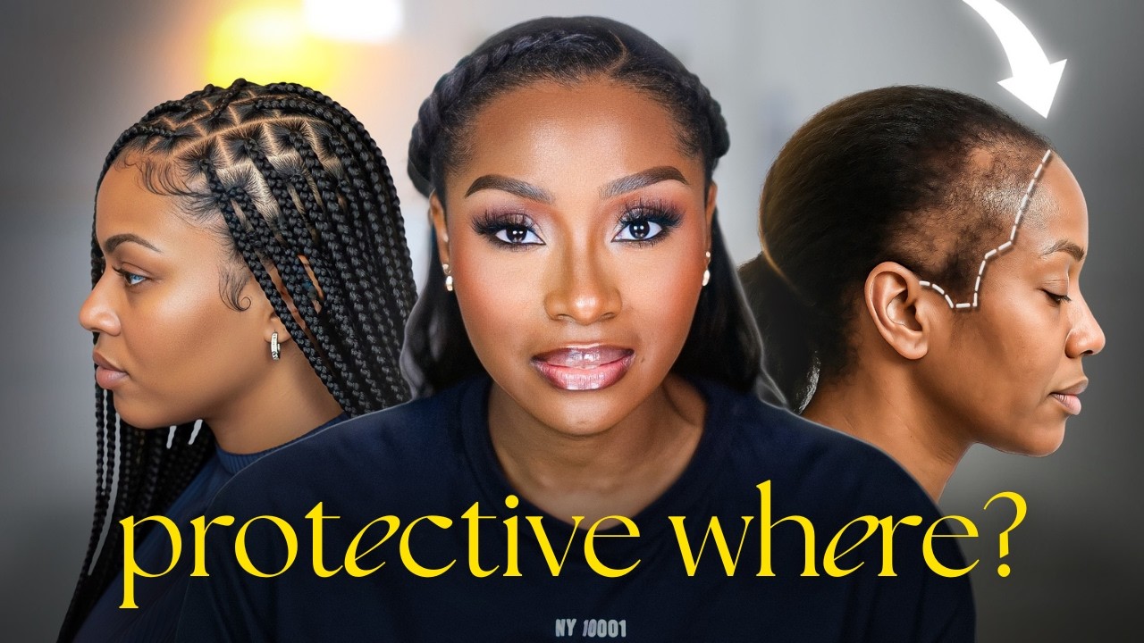 YOUR EDGES ARE DYING | We’ve Normalised Hairline Damage