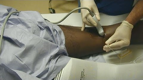 US-Guided Tibial Nerve Block- FULL VIDEO LINK BELOW