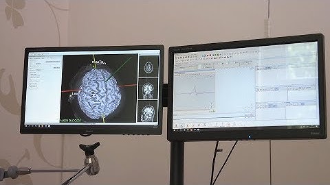 Neural Navigator "navMEP" variant