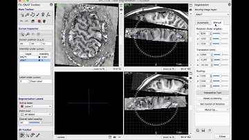 Video Tutorial on registration anatomical and layer-fMRI data with ITK-SNAP and ANTS