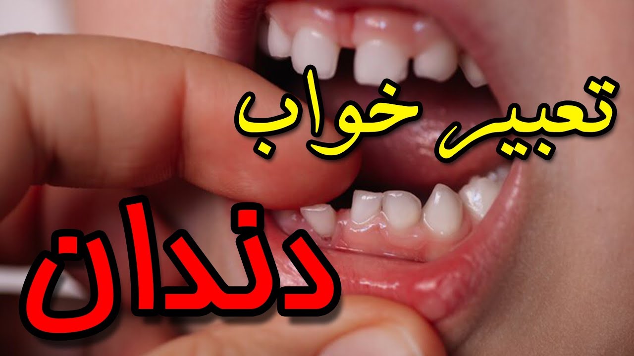 تعبیر خواب افتادن دندان بدون خونریزی
