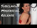 Subclavius Muscle - Self Myofascial Release - Ask Dr. Abelson