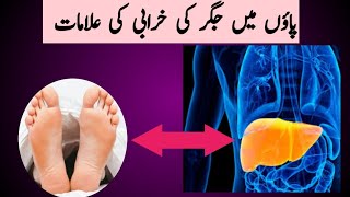 8 Things Your Feet Can Tell About Your Liver Problems| जिगर और पैर का कनेक्शन | Dr Maida Bilal |