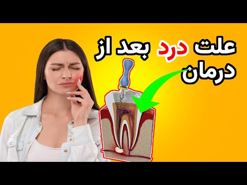 علت درد دندان بعد از عصب کشی چیست