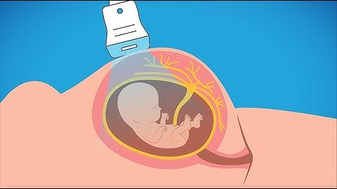 Advanced prenatal genetic testing