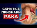 ТОП-10 первых признаков рака / Как диагностировать и предупредить рак на ранней стадии?