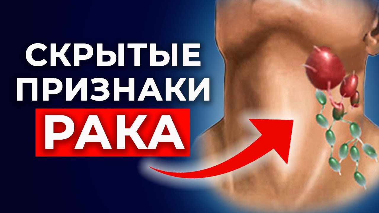 ТОП-10 первых признаков рака / Как диагностировать и предупредить рак ...