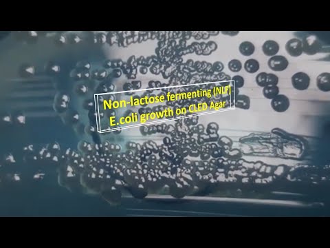 Video: Kan escherichia coli laktose fermenteer?