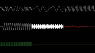 Heckin Test Zone - Act 1 Profile