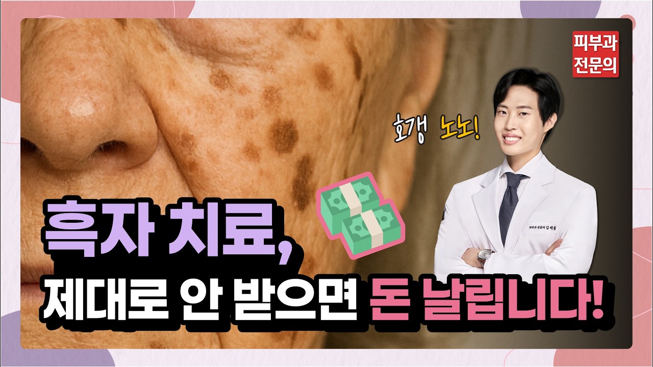 흑자 치료, 제발 제대로 알고 받으셔야 합니다! 호갱 노노🙅(흑자와 검버섯, 기미 차이점, 흑자 치료 종류, 제대로 받아야 하는 ...