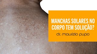 Manchas Solares No Corpo Tem Solução? - Dr. Maurizio Pupo