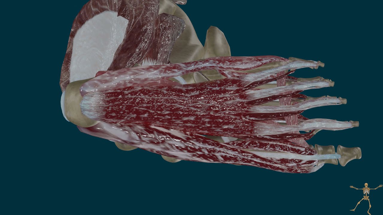 Fascitis Plantar. Mecanismos de lesión