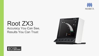 トータルアップ Root ZX3 Apex Locator: Accuracy You Can See, Results You Can Trust