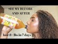 How To Lose 8 Pounds In One Week | Drinking Apple Cider Vinegar | Lose Weight Fast