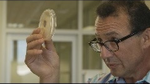 How to control Pythium in vegetable crops with Dr Len Tesoriero