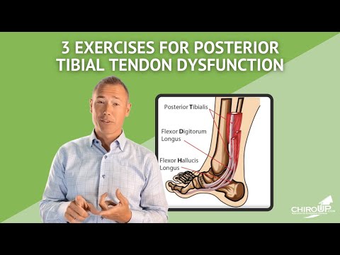 Video: Posterior Tibial Tendon Dysfunction (Tibial Nerv Dysfunktion)