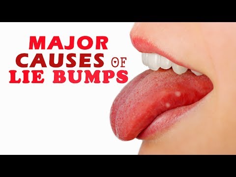 8 Major Causes of Lie Bumps