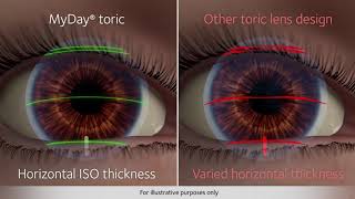 Upgrade your Astigmatic Patients to MyDay® toric screenshot 4