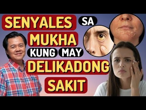Senyales sa Mukha Kung May Delikadong Sakit   By Doc Willie Ong