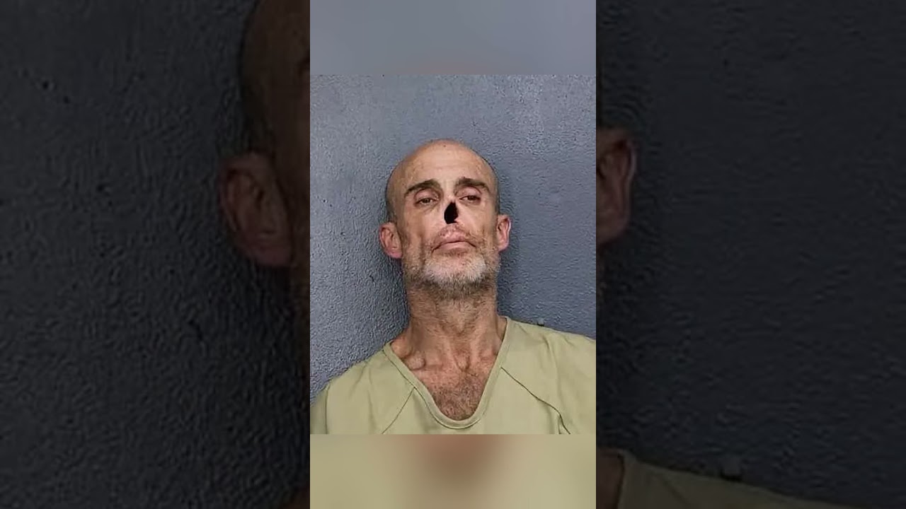 Noseless Brooklyn Man Bagged in Florida Over Meth, Cocaine Haul