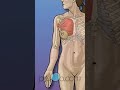 &quot;🩺 Radical Mastectomy Explained! 💔 #shorts #preop #breastcancer | PreOp® Patient Education | Body #1