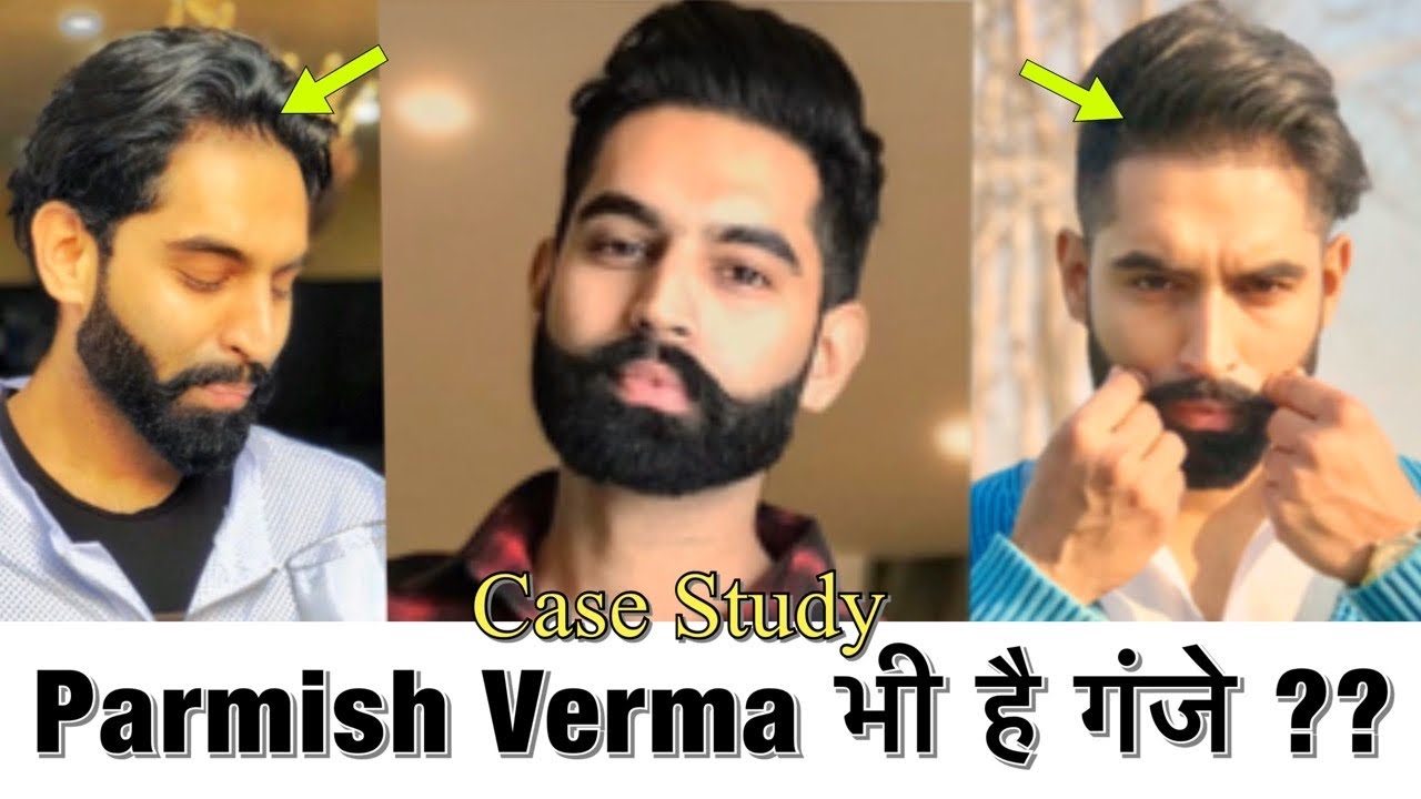 Fan off. Parmish verma daa