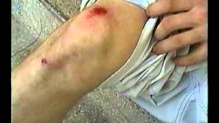 Download Lagu skating and falling jism2002 MP3