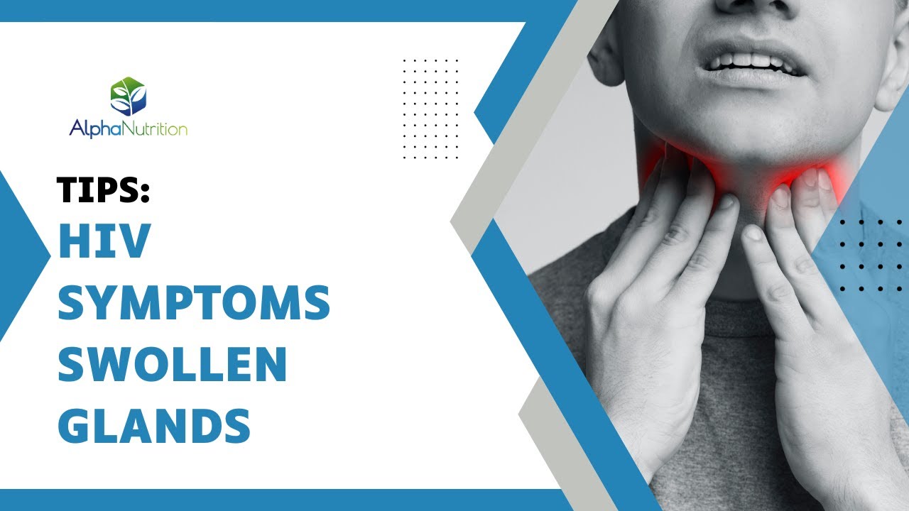 Understanding HIV Symptoms Addressing Swollen Glands YouTube