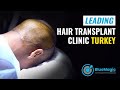 Leading hair transplant clinic turkey  bluemagic group international