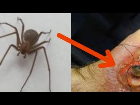 Vidéo: Araignées - Forme De Vie Dominante - Vue Alternative