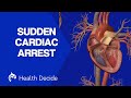 Cardiac arrest sudden death  3d animation