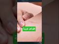 خدوش غامضة تظهر على الجسم دون سبب هل هناك قوى خفية تراقبنا