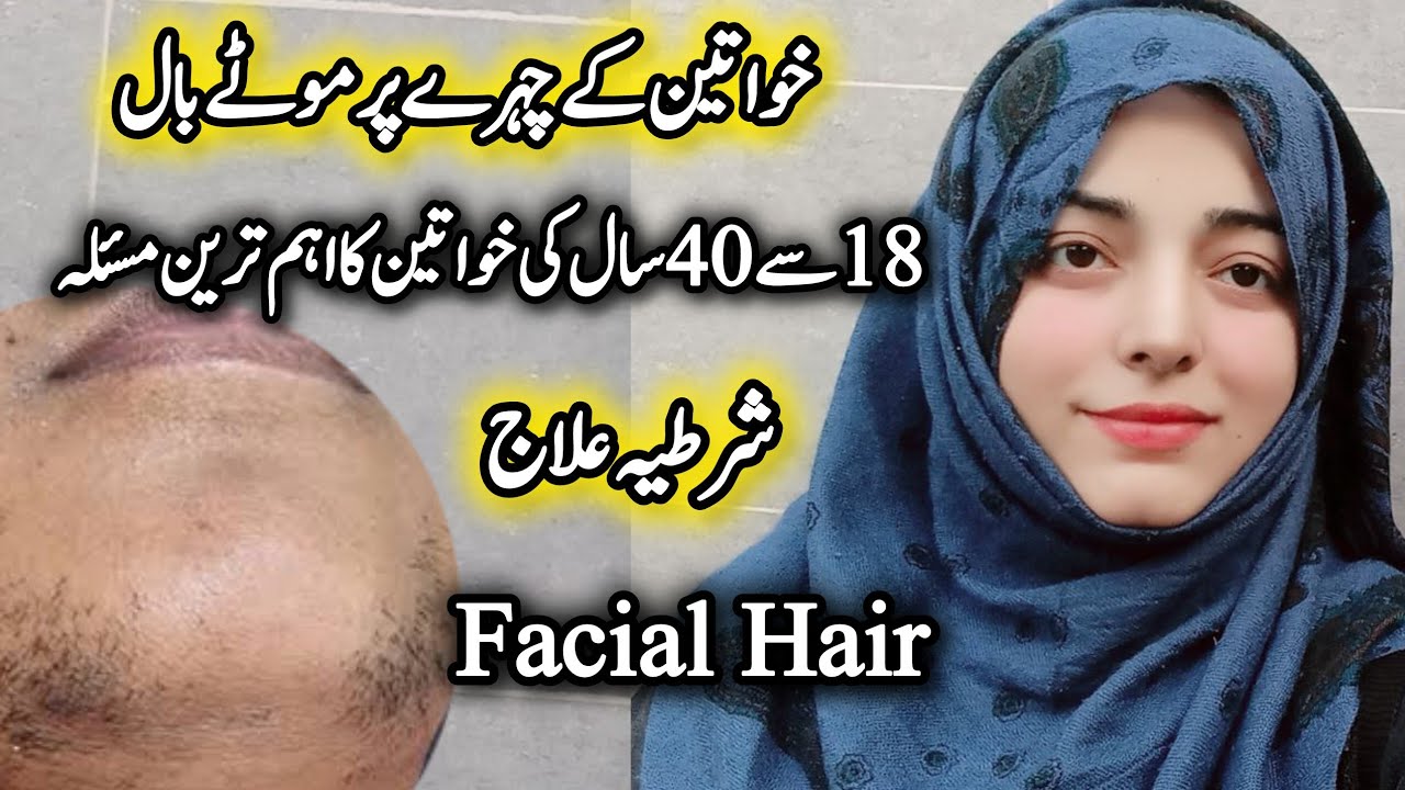 Facial Hair Removal Best & Save Method | chehry ke moty ball kaise hataye | Pcos waly Ball ka ilaaj 