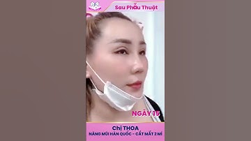 [ TMV ĐẠI HÀN] NÂNG MŨI HÀN QUỐC, CẮT MẮT HAI MÍ - CHỊ THOA