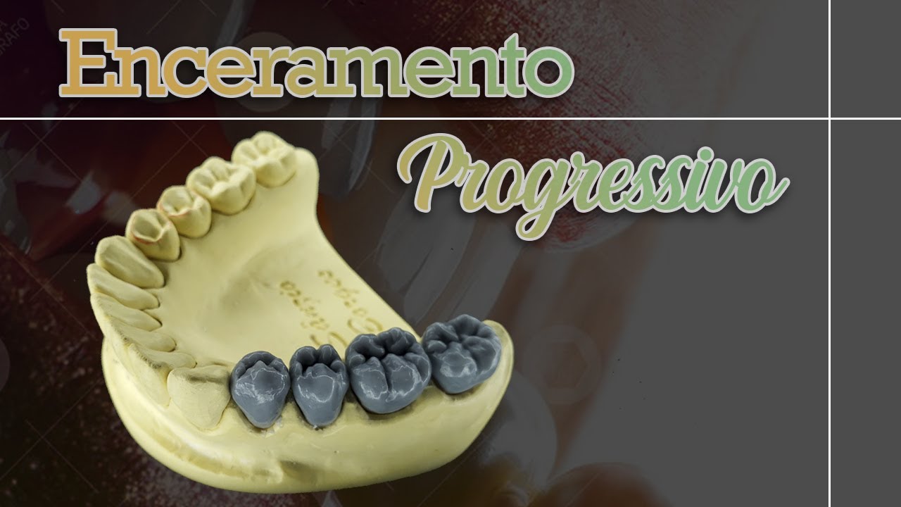Anatomia e Escultura Dental: Enceramento Progressivo - Bateria Posterior inferior [DENTES 34 AO 37]