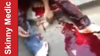Suspect Shot In The Leg - After Action Medical Report