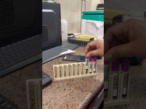 This test reveals your REAL sugar level 😳! #doctor #lablife #science