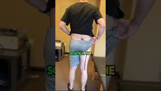The Fastest and Easiest Way To Fix Sciatica