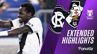 Remo Vs Vasco Da Gama 1-1 Game Highlights
