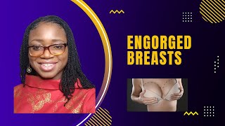 How to Prevent and Manage Engorged Breasts When Your Baby Stops Breastfeeding Abruptly