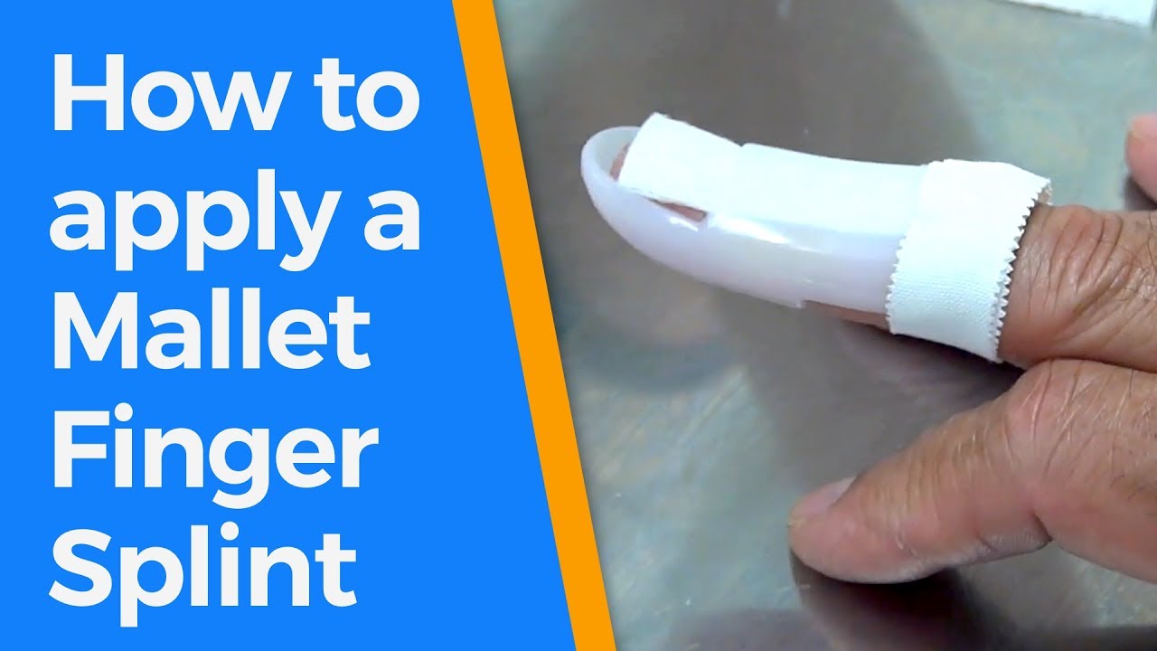 Our Favorite Mallet Finger Splints