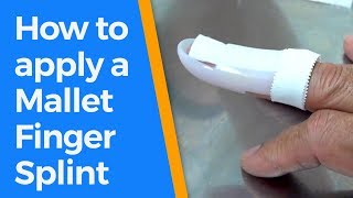How to apply a Mallet Finger Splint - YouTube