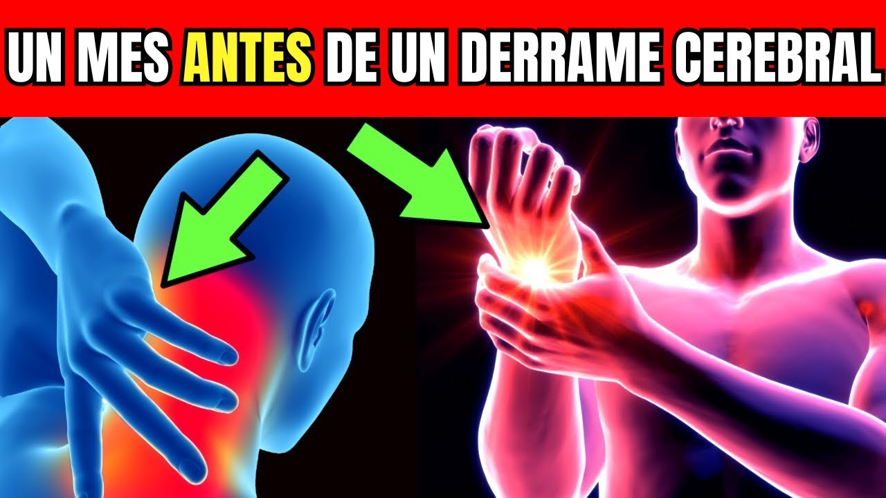 7 SEÑALES DE ADVERTENCIA 1 MES ANTES de que Ocurra UN ACV | ICTUS ...