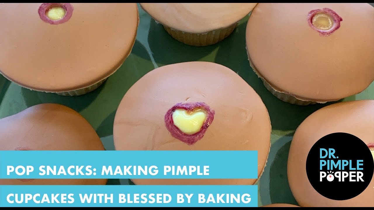 Arctic Nauwkeurig mini POP SNACKS: Making Pimple Cupcakes with Dr. Pimple Popper & Blessed By  Baking! - YouTube