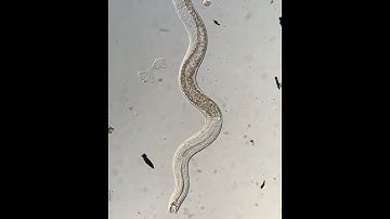 A nematode worm under a microscope.