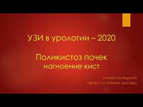 Поликистоз почек. Нагноение кист. Феданов Станислав Леонидович.