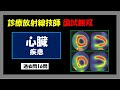 【診療放射線技師国家試験】 心臓　疾患