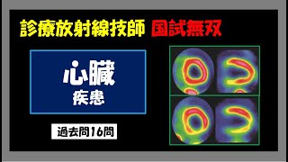 【診療放射線技師国家試験】 心臓　疾患
