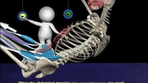 The Proper Technique for a Sit-Up: 3D Animation of Muscles in Motion